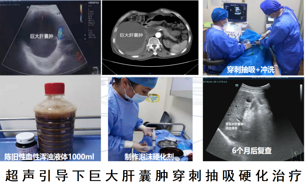 64818dca442b4.png