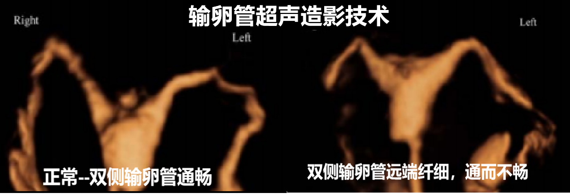 64818e9aa296c.png