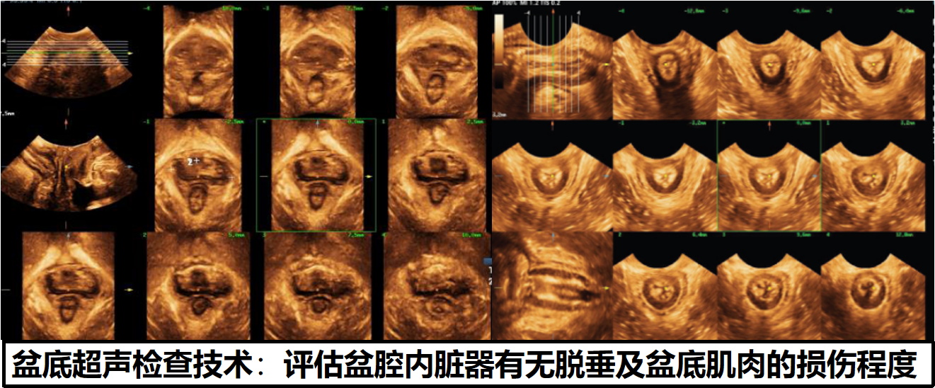 64818ec7491d5.png